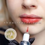 اپیلاسیون کل بدن