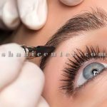 اپیلاسیون کل بدن