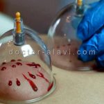 مرکز زالو درمانی شرق تهران