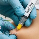 دستگاه لاغری غرب تهران