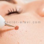 مرکز زالو درمانی شرق تهران